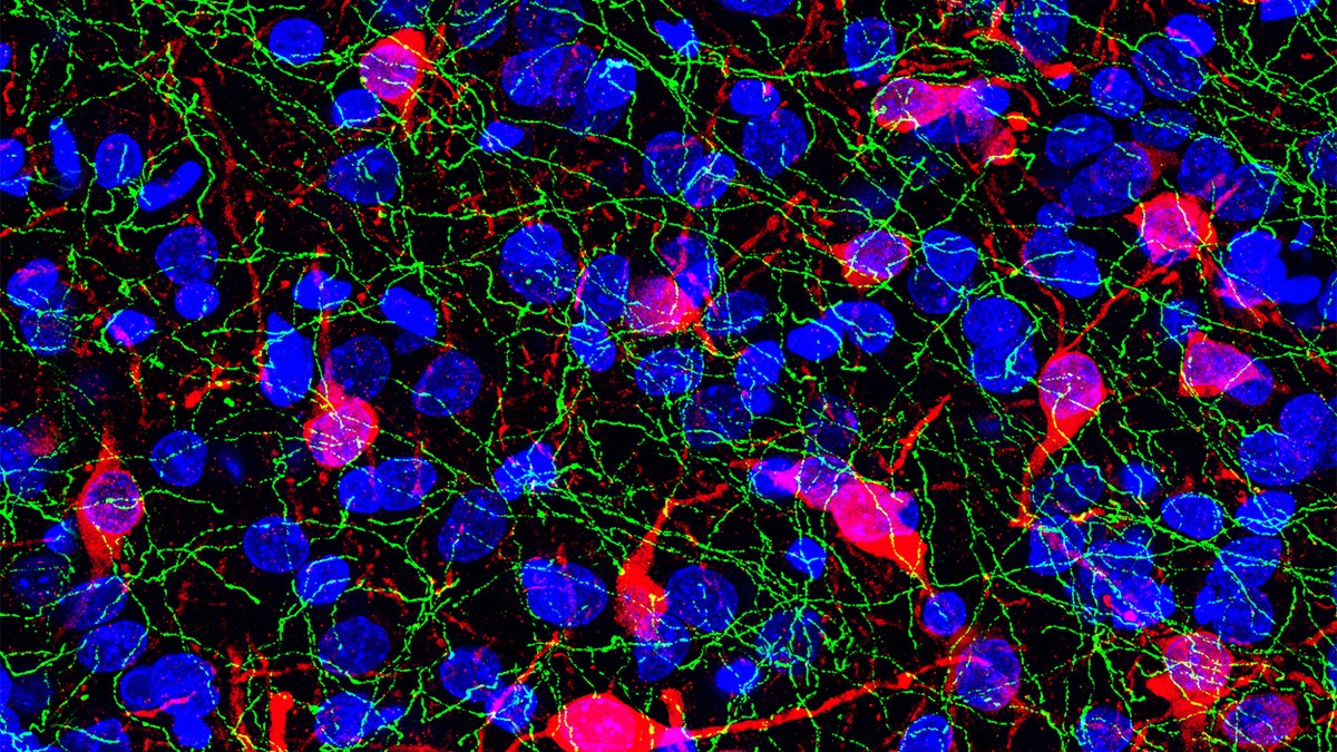 Fluorescent neurons of the brain's appetite-regulating circuitry — the biology behind incretin appetite regulation in the brain; a Septarutide brief by Panacea Bio Chem and Bogdan Dicoias