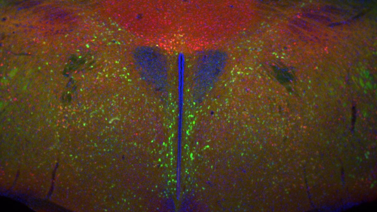 Labelled neurons of the hypothalamus — the brain's appetite-control hub where incretins act; a Septarutide brief on incretin appetite regulation in the brain by Panacea Bio Chem and Bogdan Dicoias